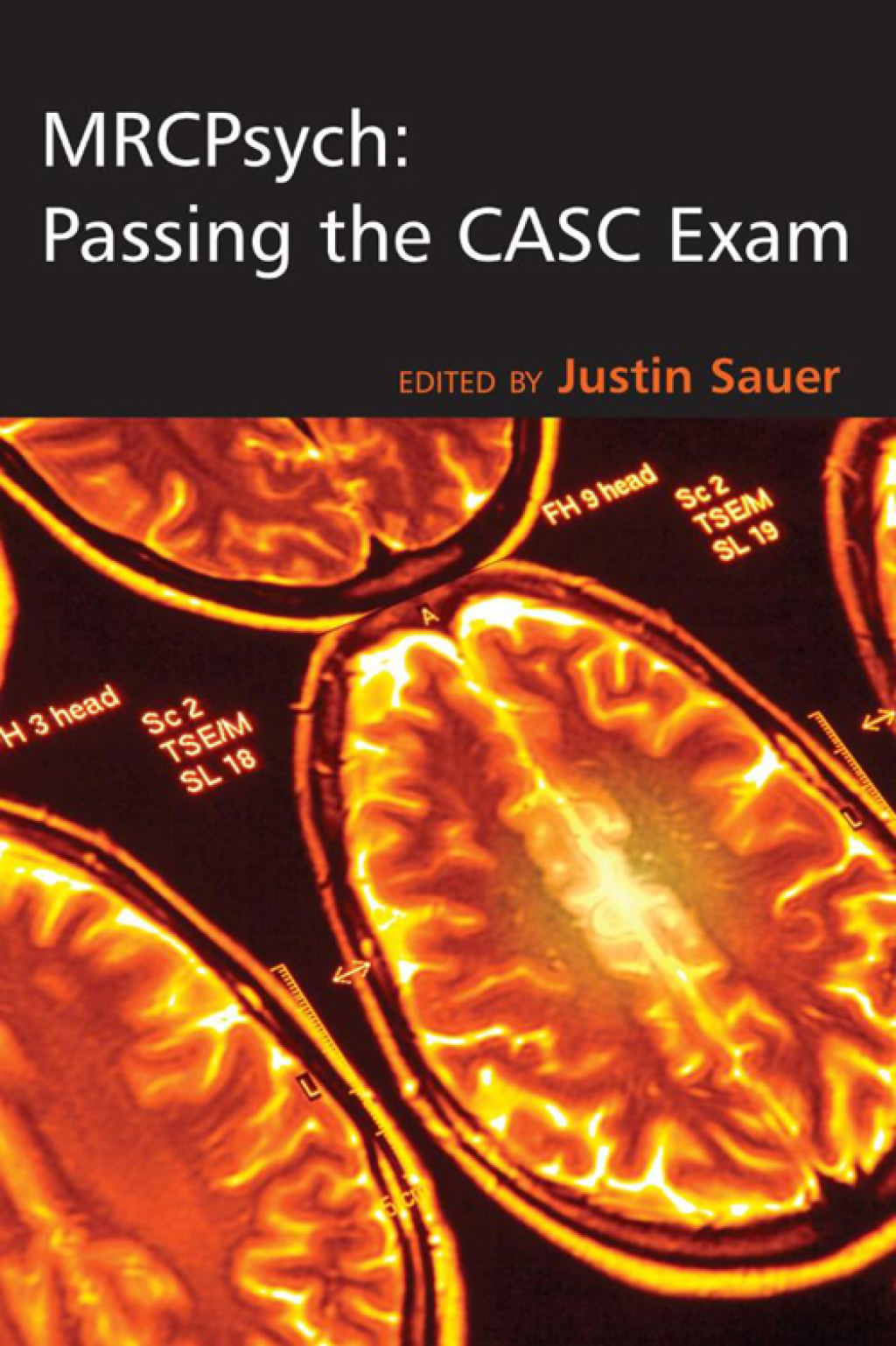 MRCPsych: Passing the CASC Exam 1st Edition â€“ PDF/EPUB Version Downloadable