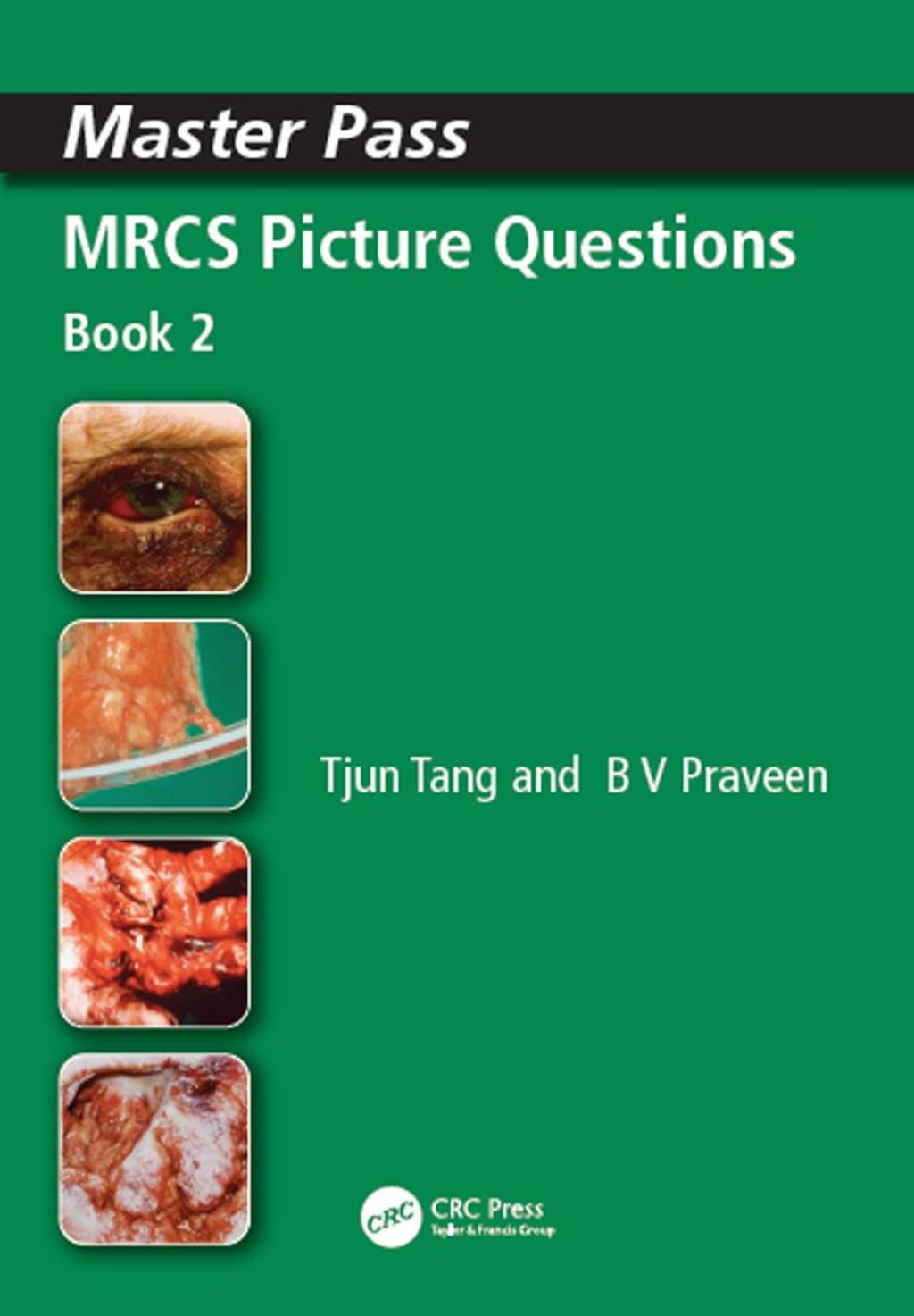 MRCS Picture Questions A Practical Guide, v. 3 1st Edition â€“ PDF/EPUB Version Downloadable