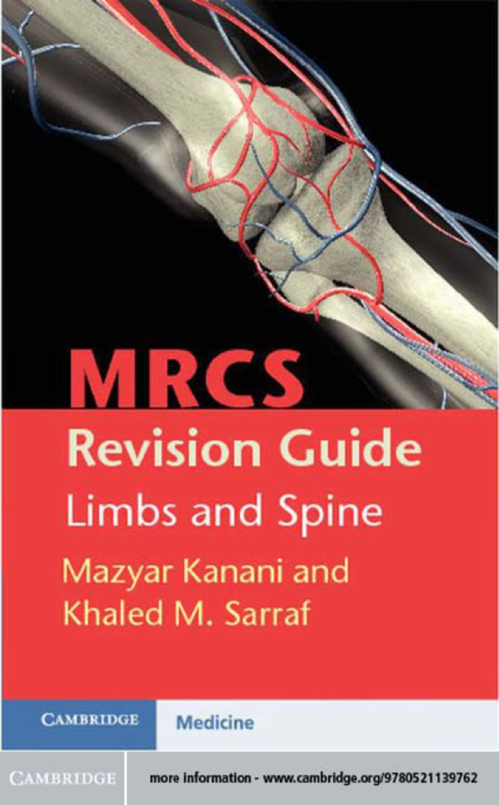 MRCS Revision Guide: Limbs and Spine  â€“ PDF/EPUB Version Downloadable