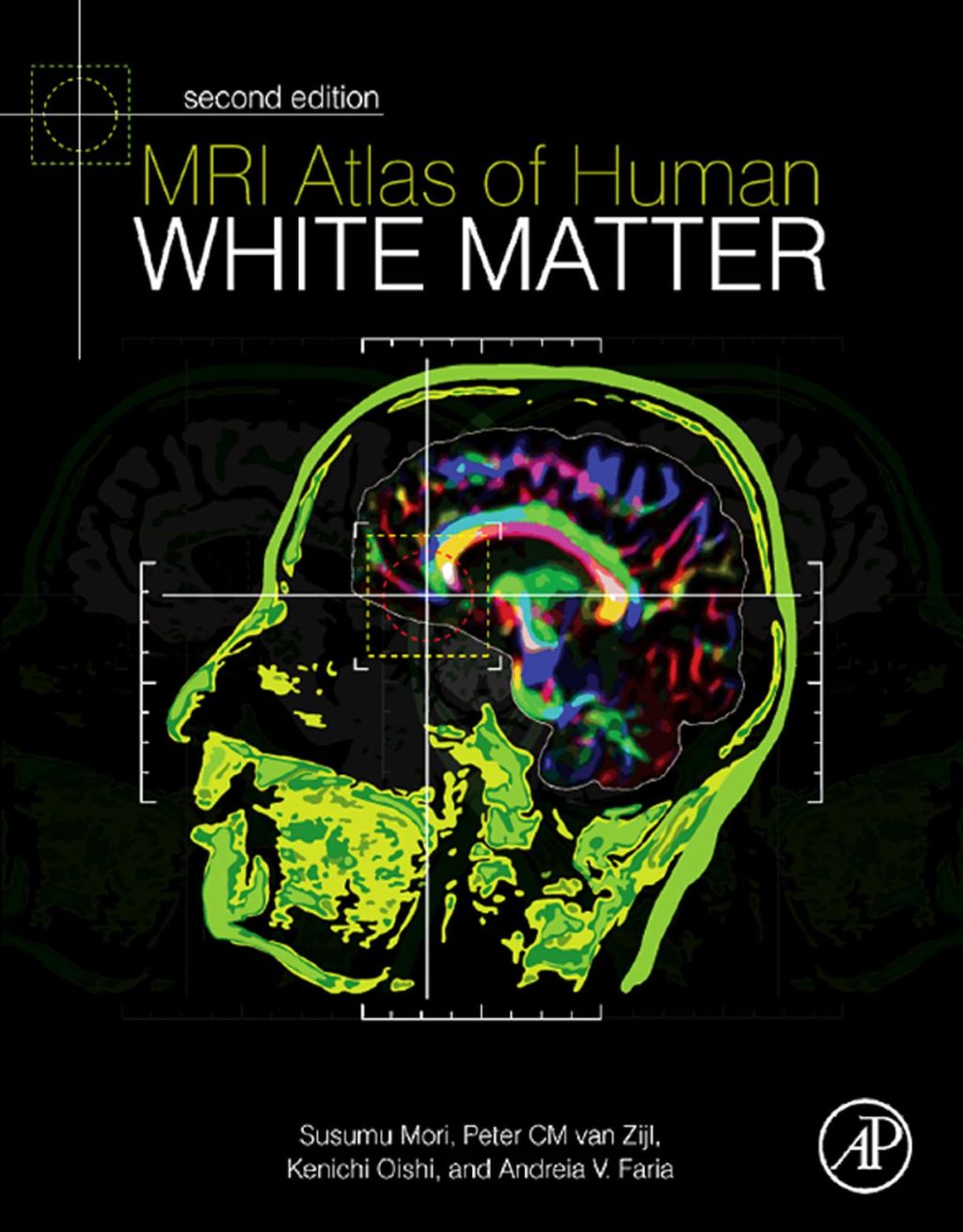 MRI Atlas of Human White Matter 2nd Edition â€“ PDF/EPUB Version Downloadable