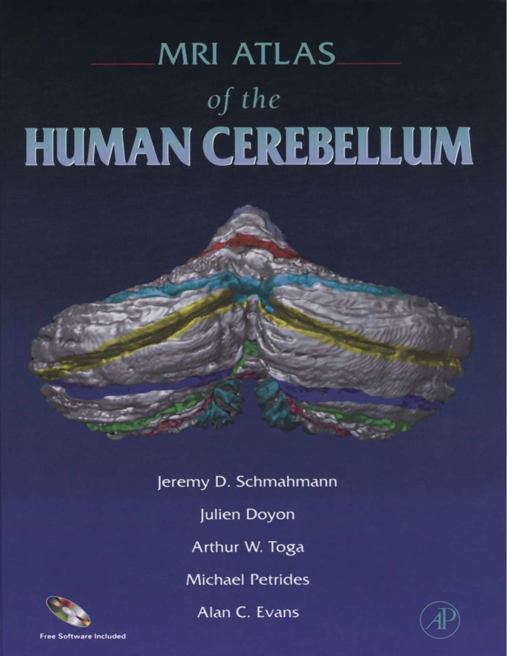 MRI Atlas of the Human Cerebellum  â€“ PDF/EPUB Version Downloadable