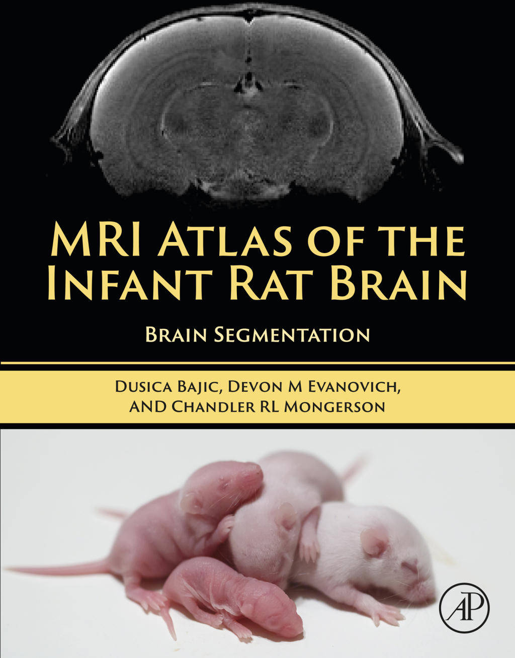MRI Atlas of the Infant Rat Brain Brain Segmentation  â€“ PDF/EPUB Version Downloadable