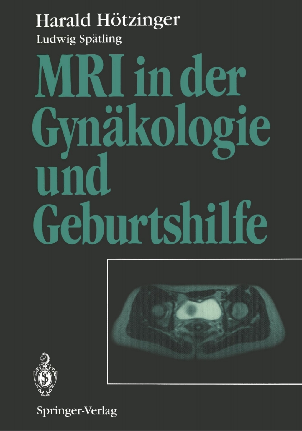 MRI in der GynÃ¤kologie und Geburtshilfe  â€“ PDF/EPUB Version Downloadable