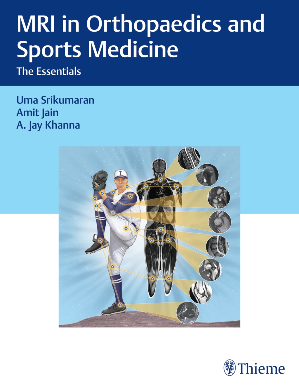 MRI in Orthopaedics and Sports Medicine The Essentials 1st Edition â€“ PDF/EPUB Version Downloadable