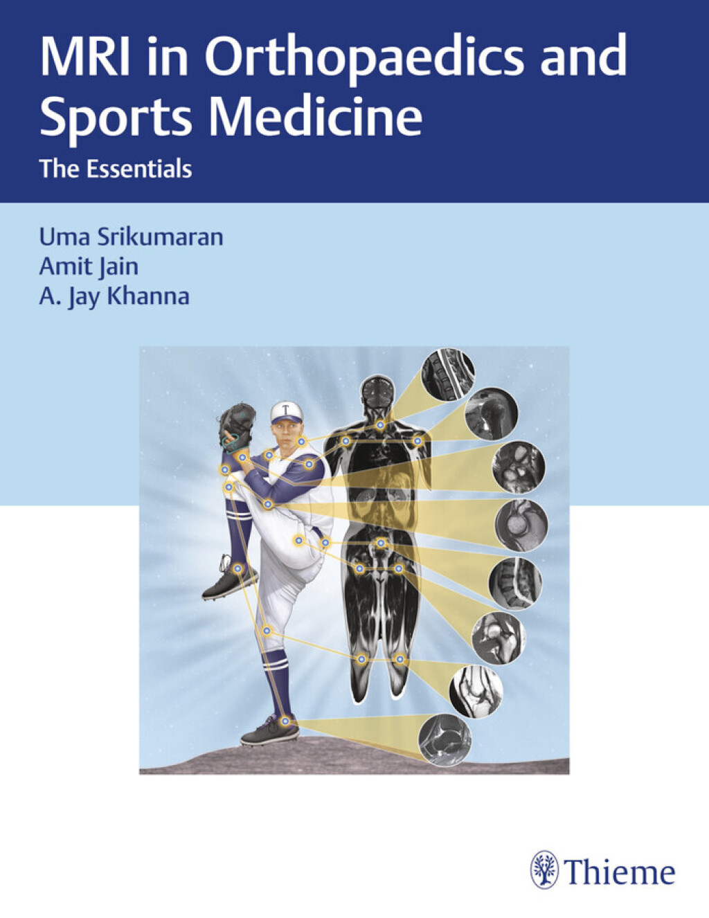 MRI in Orthopaedics and Sports Medicine The Essentials 1st Edition â€“ PDF/EPUB Version Downloadable