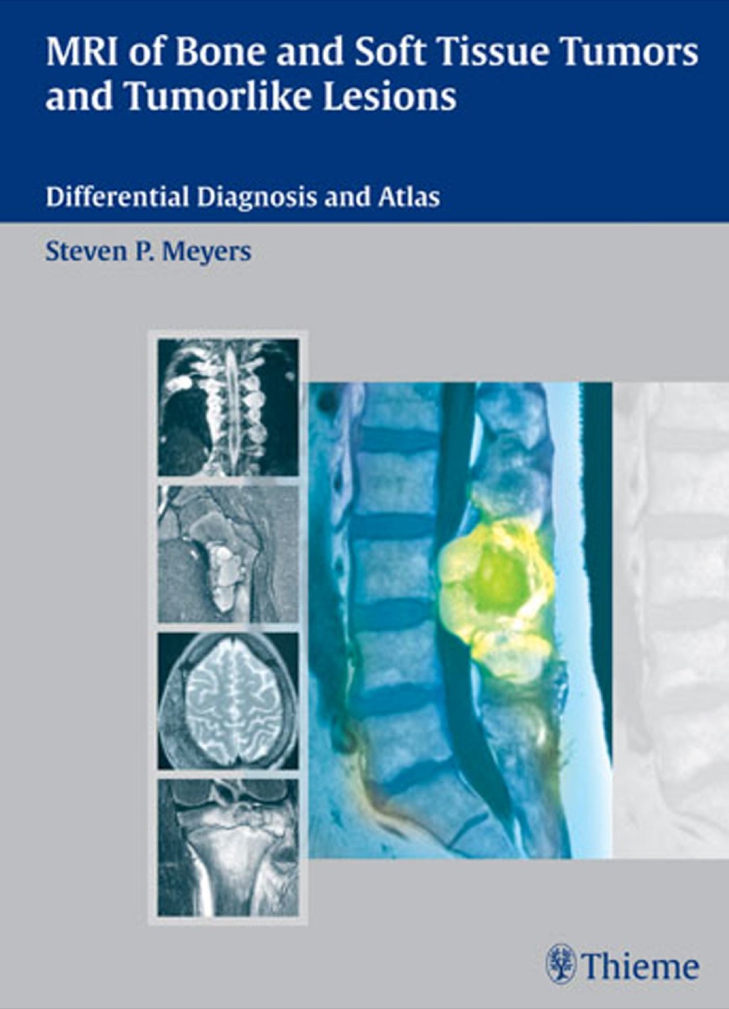 MRI of Bone and Soft Tissue Tumors and Tumorlike Lesions Differential Diagnosis and Atlas 1st Edition â€“ PDF/EPUB Version Downloadable