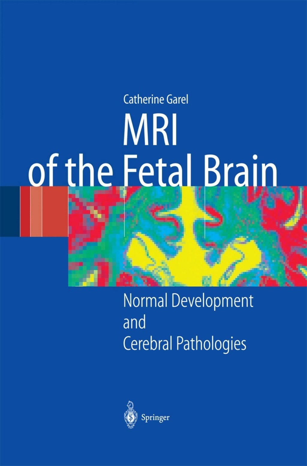 MRI of the Fetal Brain Normal Development and Cerebral Pathologies â ...
