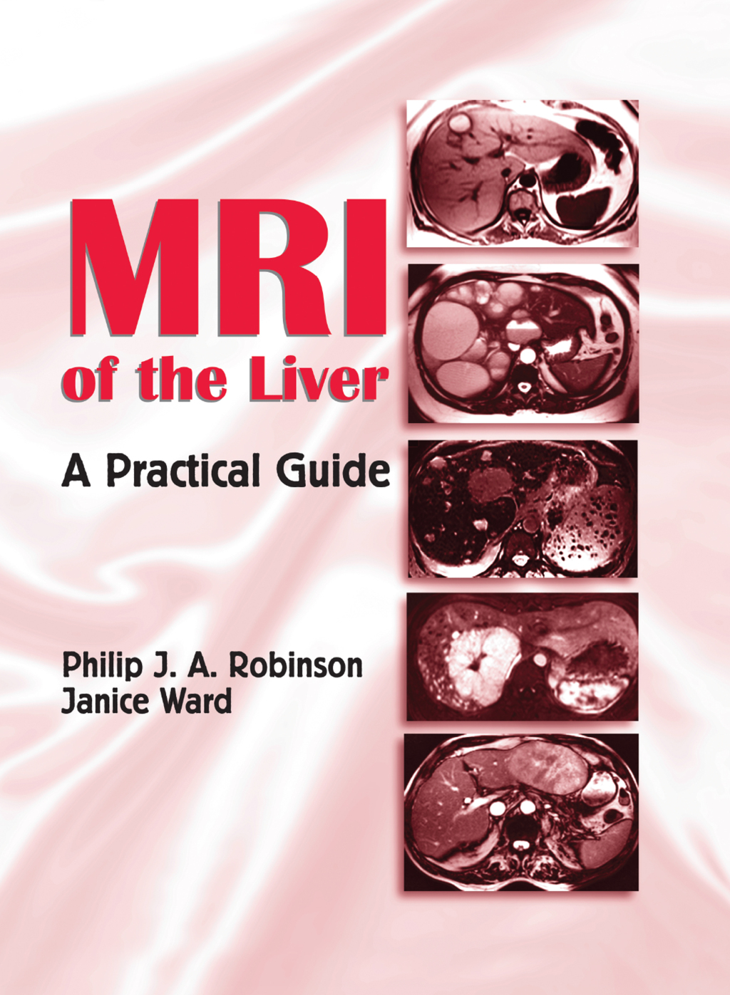 MRI of the Liver A Practical Guide 1st Edition â€“ PDF/EPUB Version Downloadable