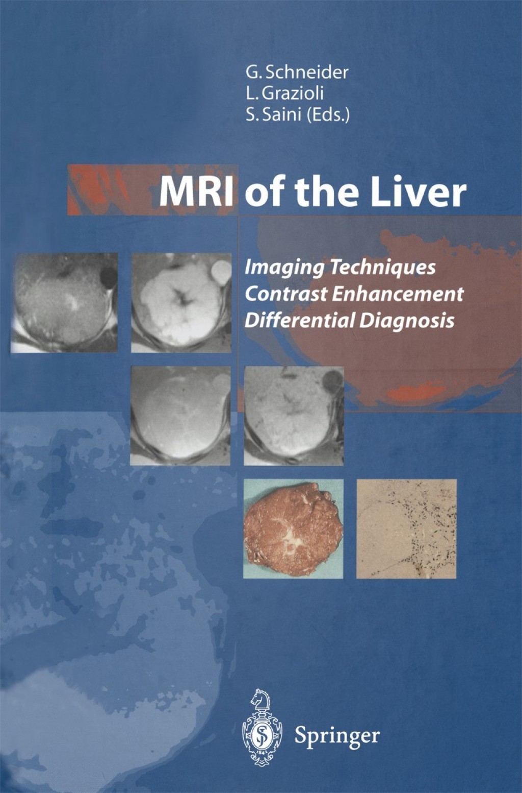 MRI of the Liver Imaging Techniques Contrast Enhancement Differential Diagnosis 1st Edition â€“ PDF/EPUB Version Downloadable