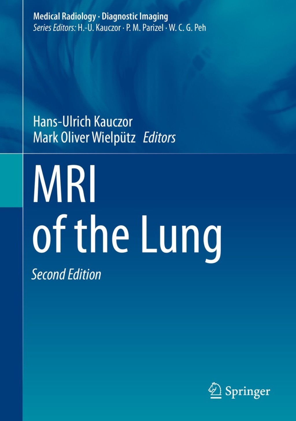 MRI of the Lung 2nd Edition â€“ PDF/EPUB Version Downloadable