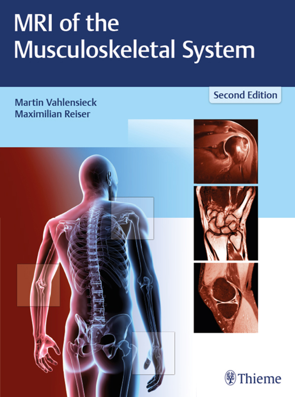 MRI of the Musculoskeletal System 2nd Edition â€“ PDF/EPUB Version Downloadable