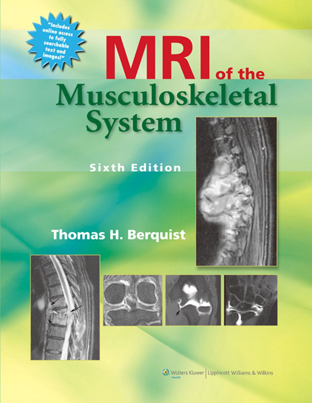 MRI of the Musculoskeletal System 6th Edition â€“ PDF/EPUB Version Downloadable