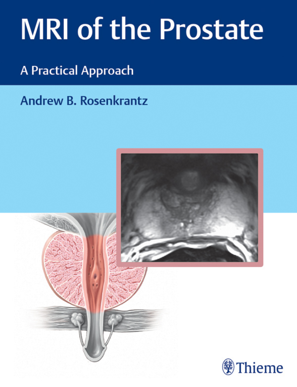 MRI of the Prostate A Practical Approach 1st Edition â€“ PDF/EPUB Version Downloadable