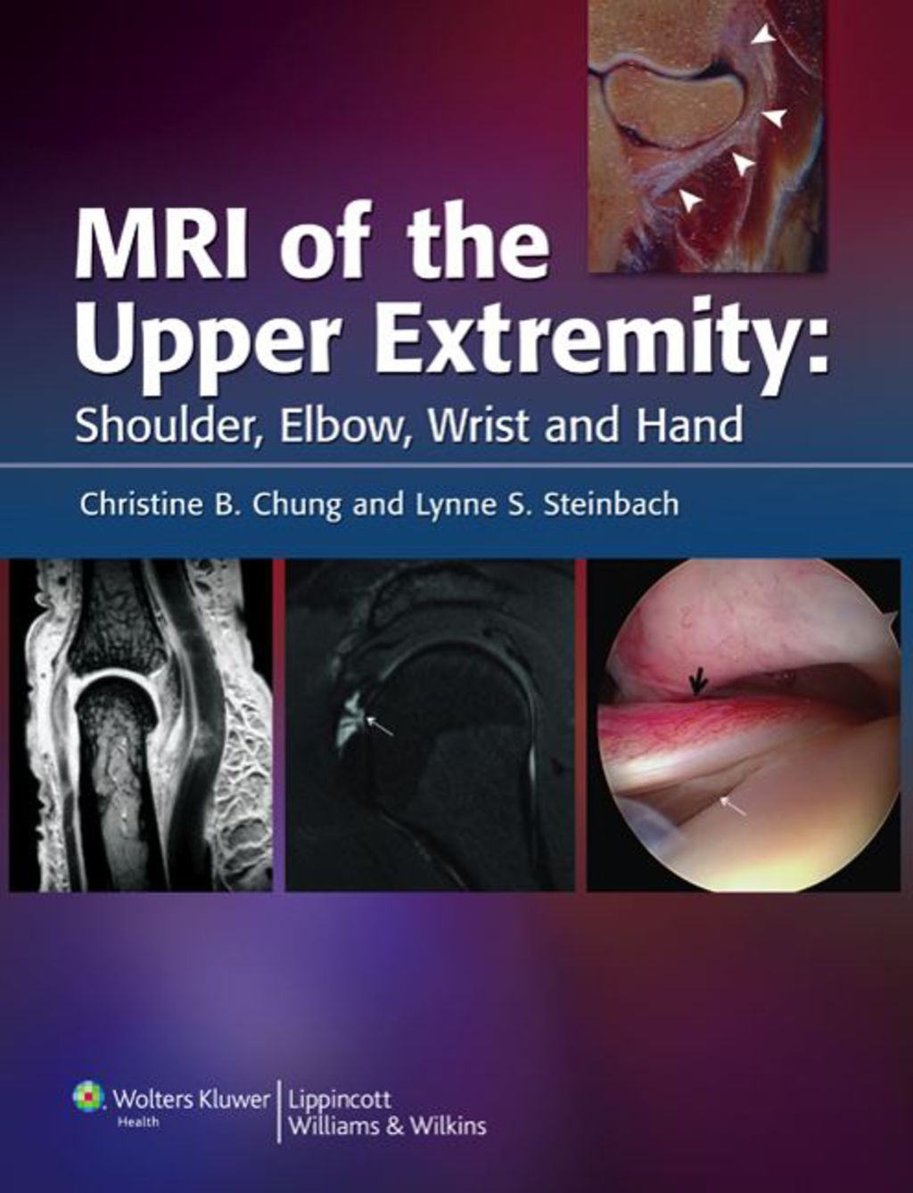 MRI of the Upper Extremity 1st Edition â€“ PDF/EPUB Version Downloadable