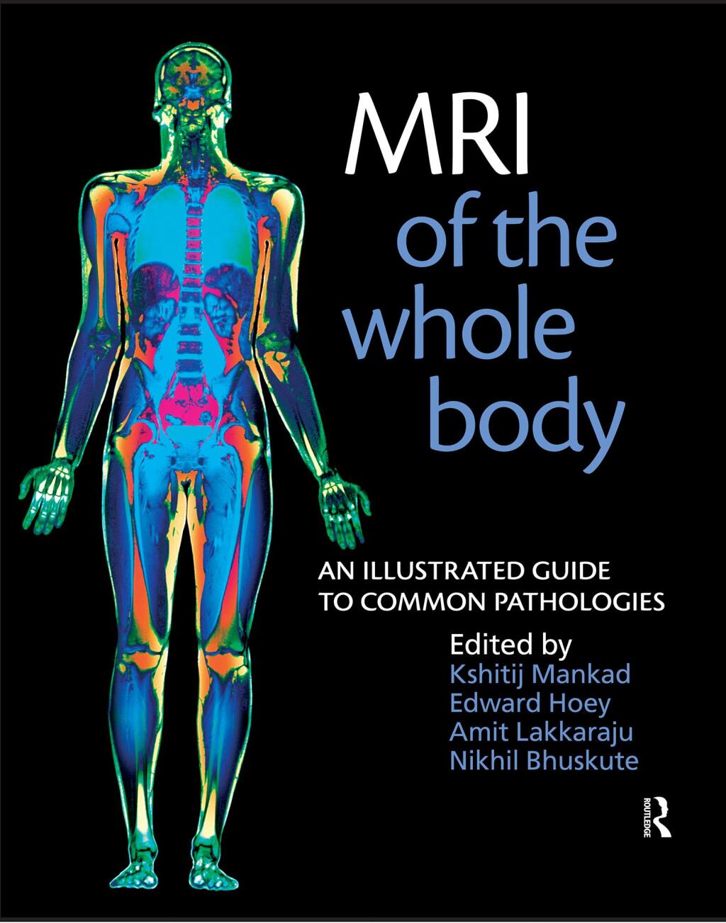 MRI of the Whole Body An Illustrated Guide for Common Pathologies 1st Edition â€“ PDF/EPUB Version Downloadable