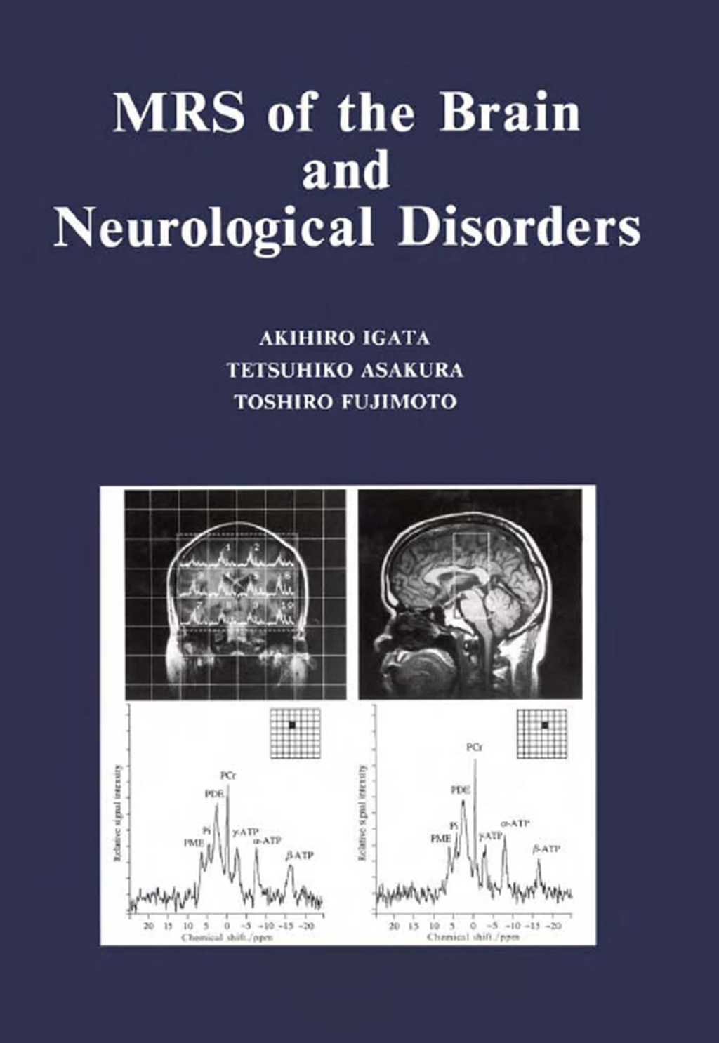 MRS of the Brain and Neurological Disorders 1st Edition â€“ PDF/EPUB Version Downloadable