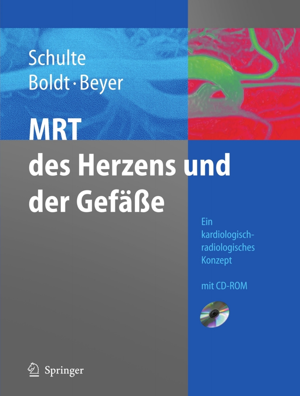 MRT des Herzens und der GefÃ¤ÃŸe Indikationen - Strategien - AblÃ¤ufe - Ergebnisse  â€“ PDF/EPUB Version Downloadable