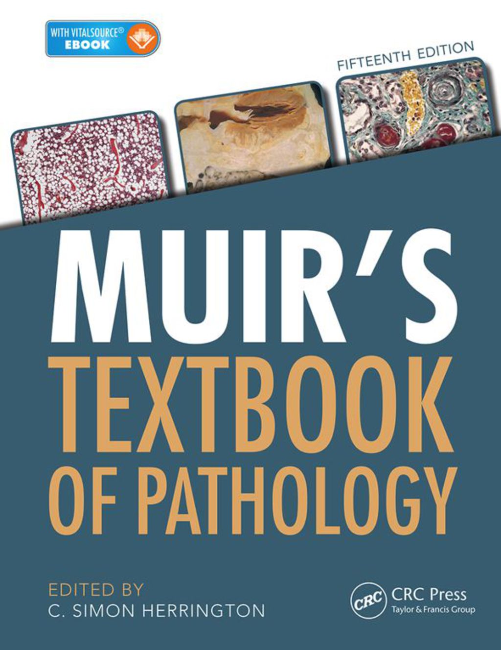 Muir's Textbook of Pathology 15th Edition â€“ PDF/EPUB Version Downloadable