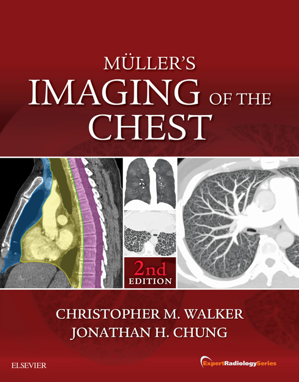 Muller's Imaging of the Chest E-Book Expert Radiology Series 2nd Edition â€“ PDF/EPUB Version Downloadable