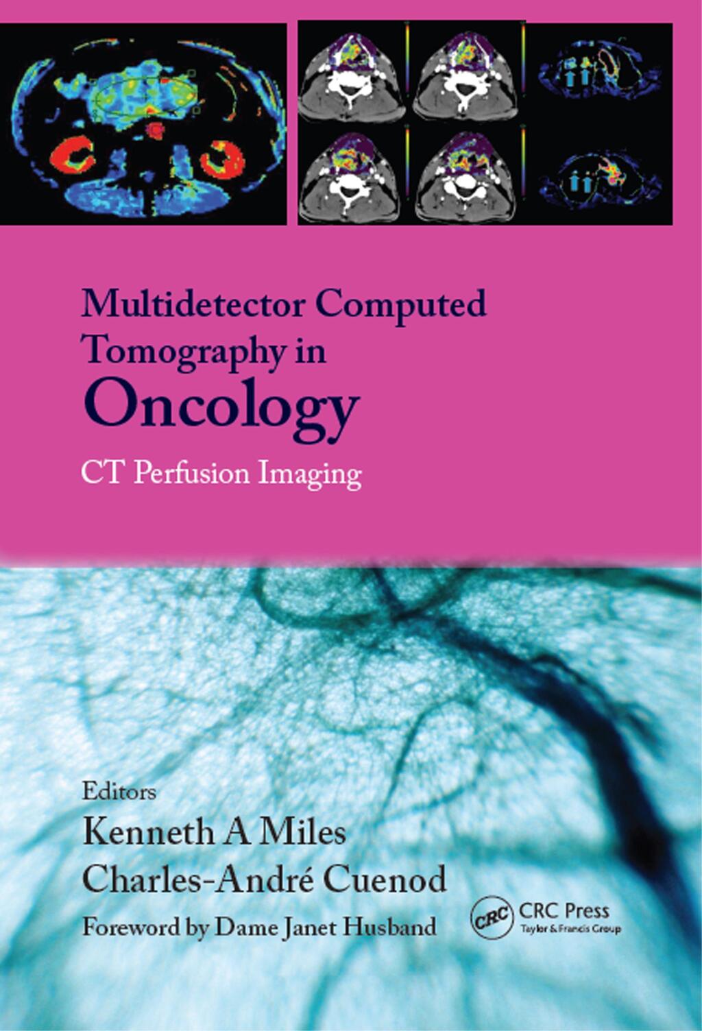 Multi-Detector Computed Tomography in Oncology CT Perfusion Imaging 1st Edition â€“ PDF/EPUB Version Downloadable