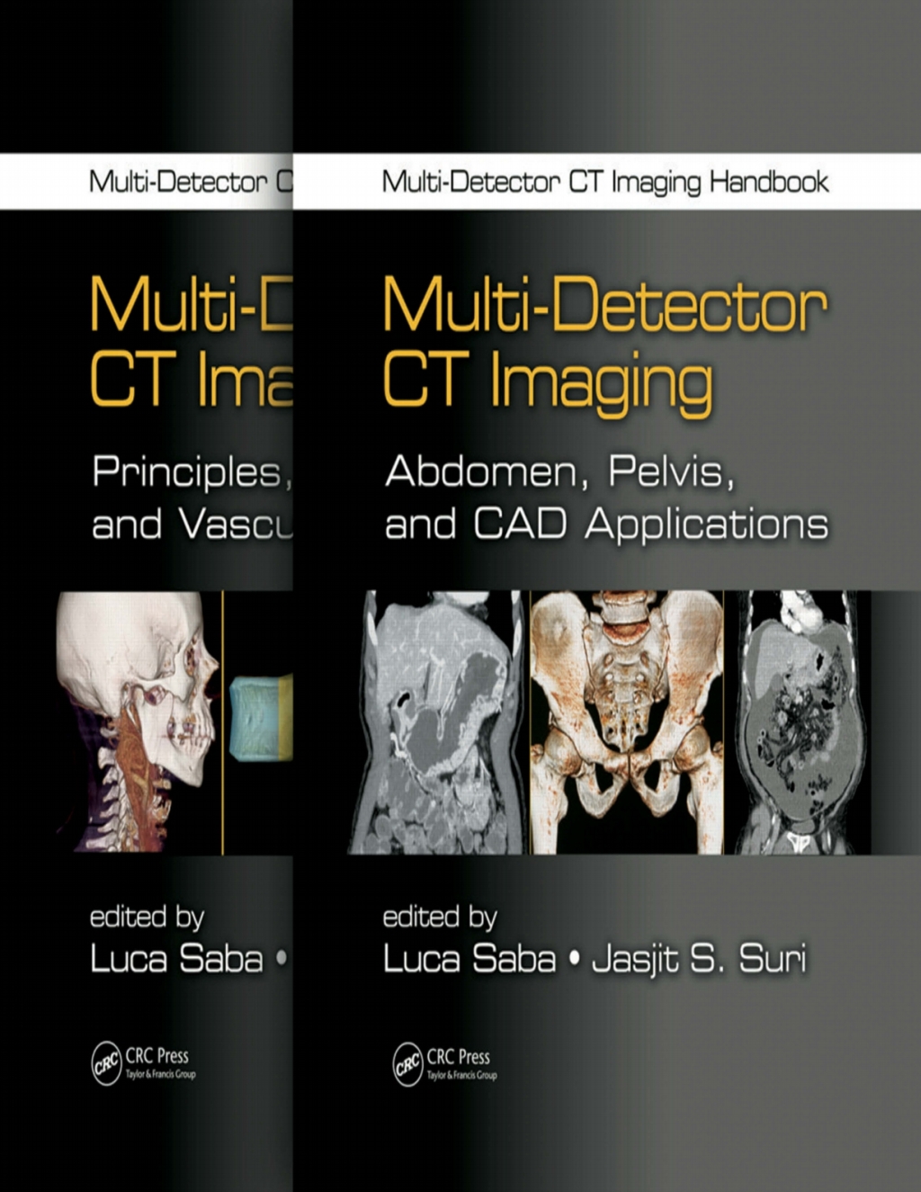 Multi-Detector CT Imaging Handbook, Two Volume Set 1st Edition â€“ PDF/EPUB Version Downloadable