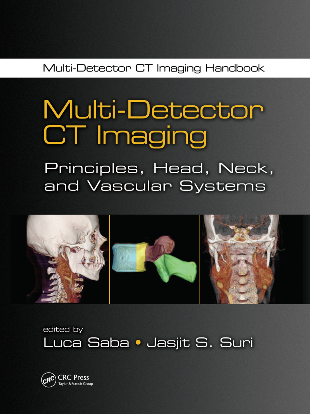 Multi-Detector CT Imaging Principles, Head, Neck, and Vascular Systems 1st Edition â€“ PDF/EPUB Version Downloadable
