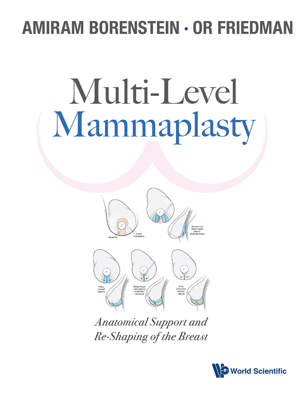 Multi-Level Mammaplasty: Anatomical Support and Re-Shaping of the Breast  â€“ PDF/EPUB Version Downloadable