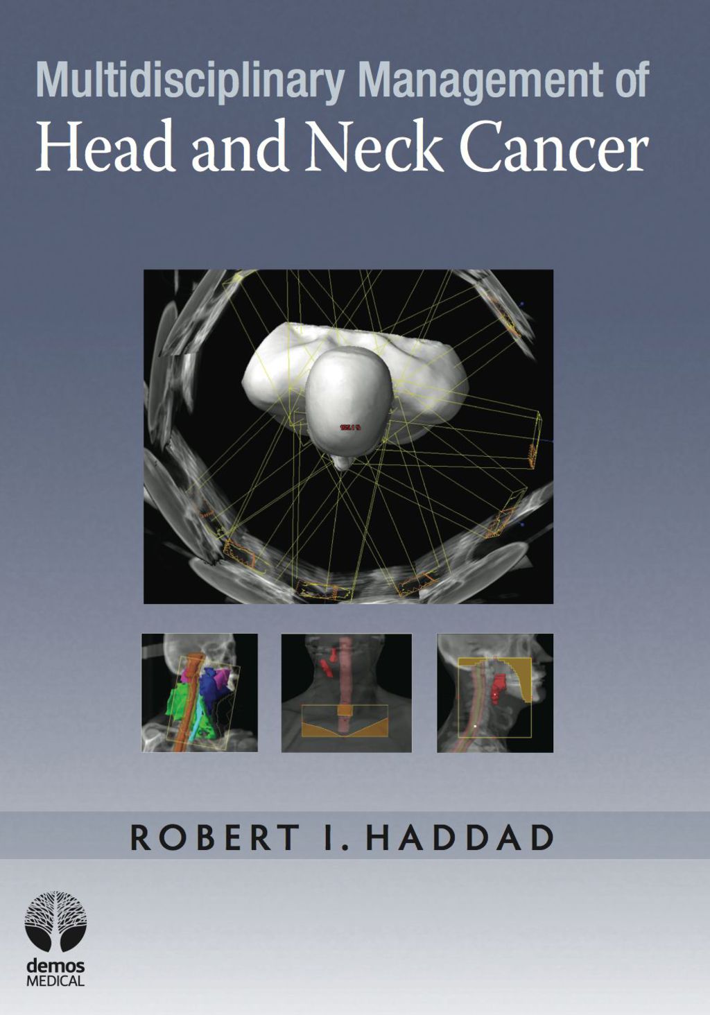Multidisciplinary Management of Head and Neck Cancer 1st Edition â€“ PDF/EPUB Version Downloadable