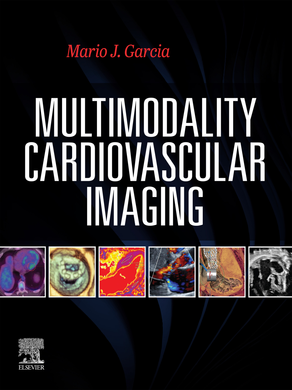 Multimodal Cardiac Imaging 1st Edition â€“ PDF/EPUB Version Downloadable