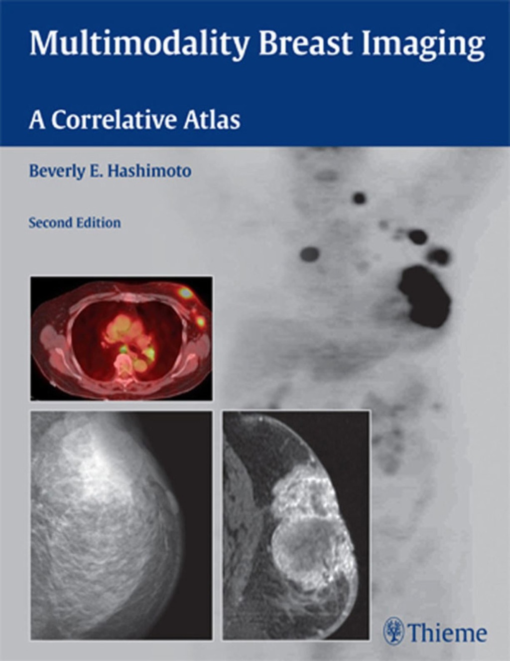 Multimodality Breast Imaging A Correlative Atlas 2nd Edition â€“ PDF/EPUB Version Downloadable