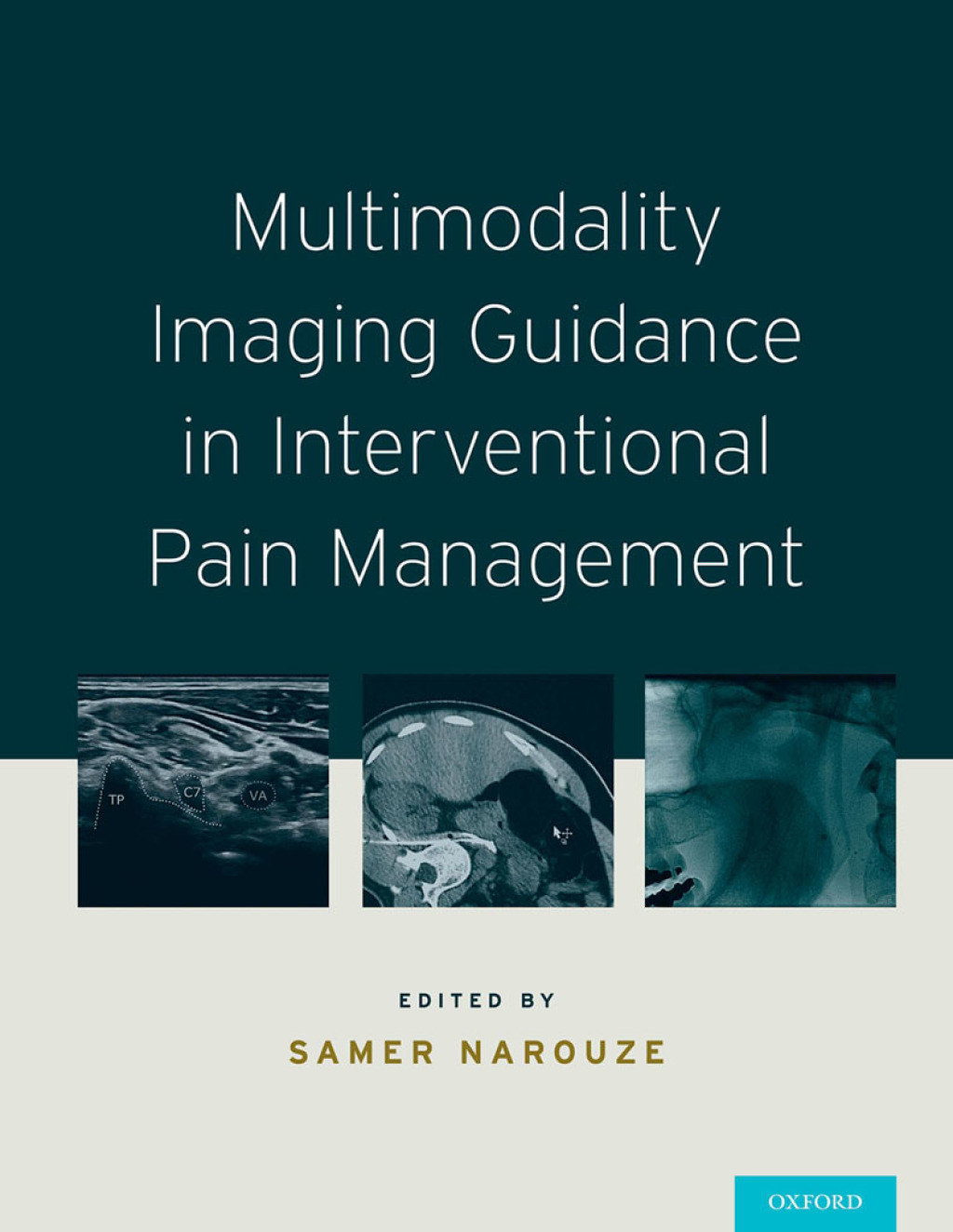 Multimodality Imaging Guidance in Interventional Pain Management 1st Edition â€“ PDF/EPUB Version Downloadable