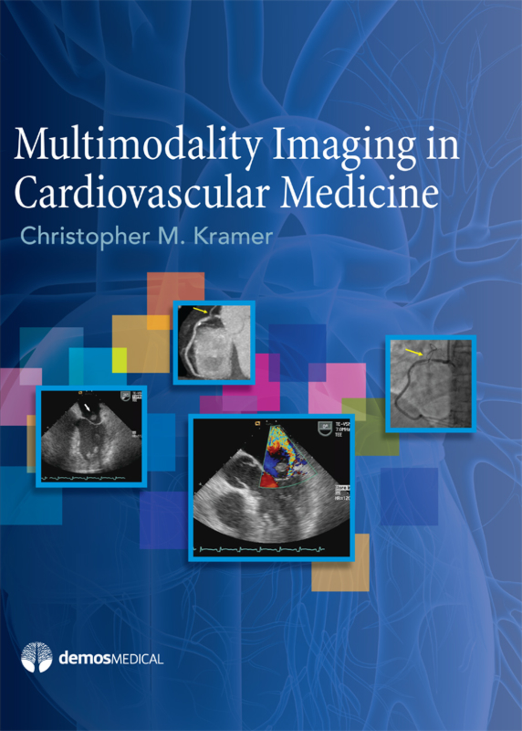 Multimodality Imaging in Cardiovascular Medicine 1st Edition â€“ PDF/EPUB Version Downloadable