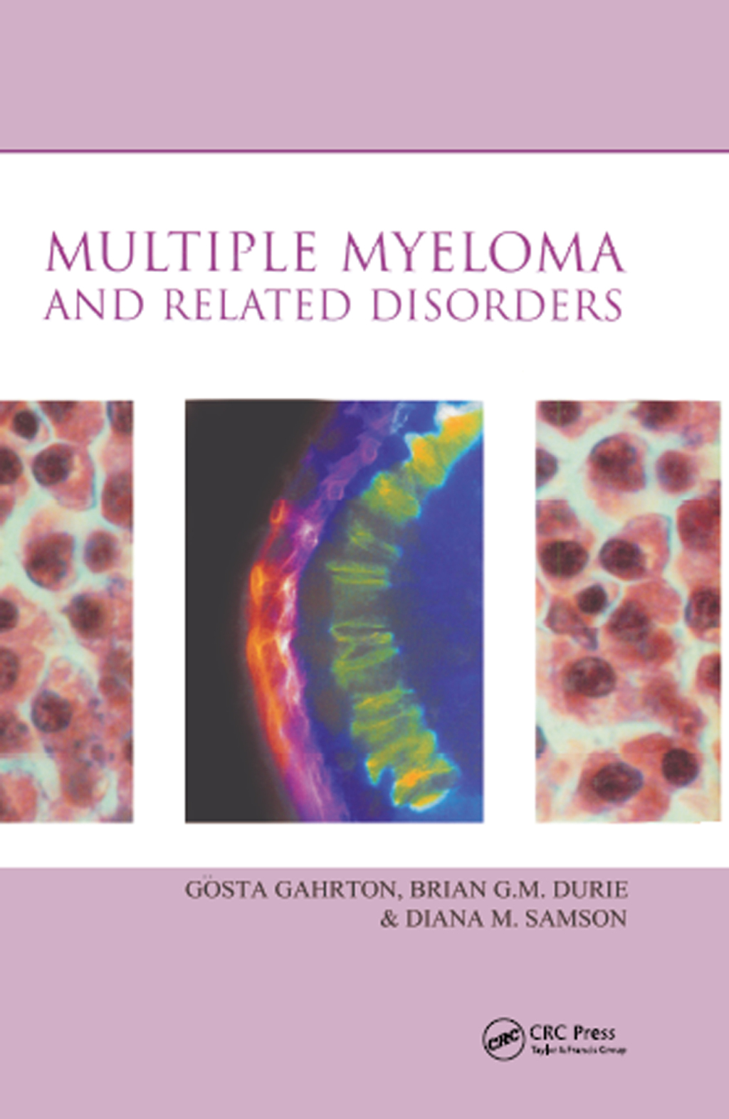Multiple Myeloma and Related Disorders 1st Edition â€“ PDF/EPUB Version Downloadable