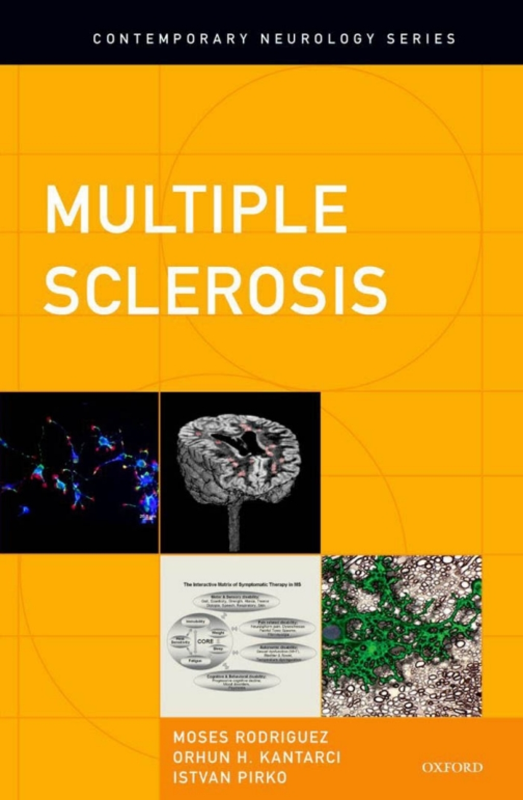 Multiple Sclerosis  â€“ PDF/EPUB Version Downloadable