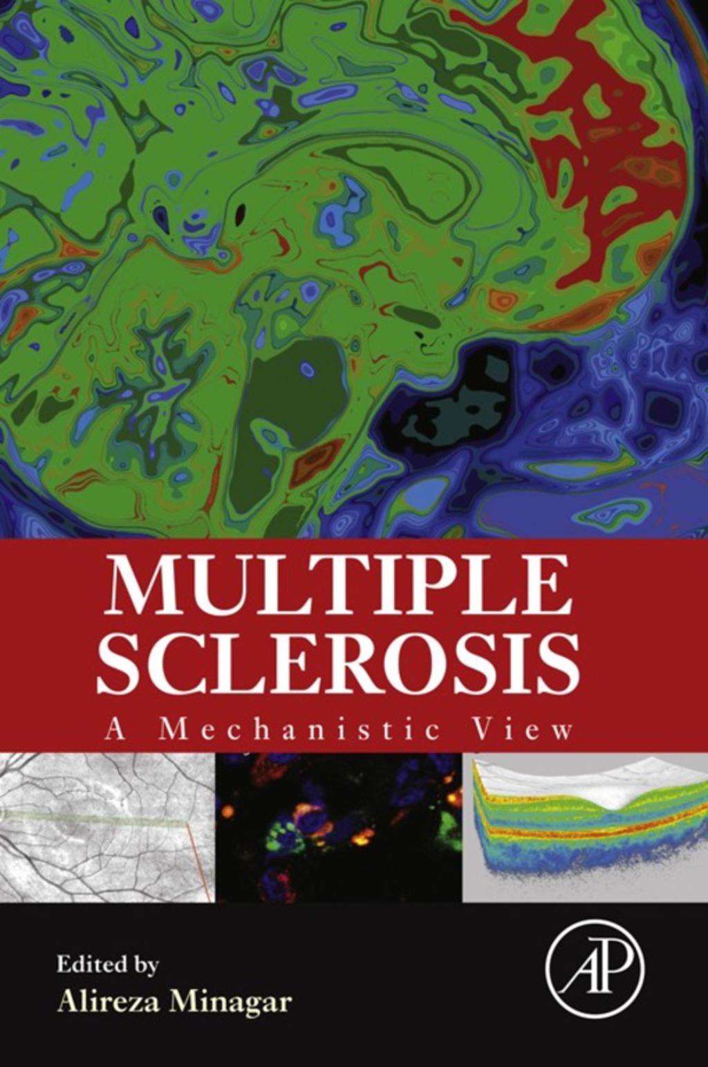 Multiple Sclerosis: A Mechanistic View  â€“ PDF/EPUB Version Downloadable