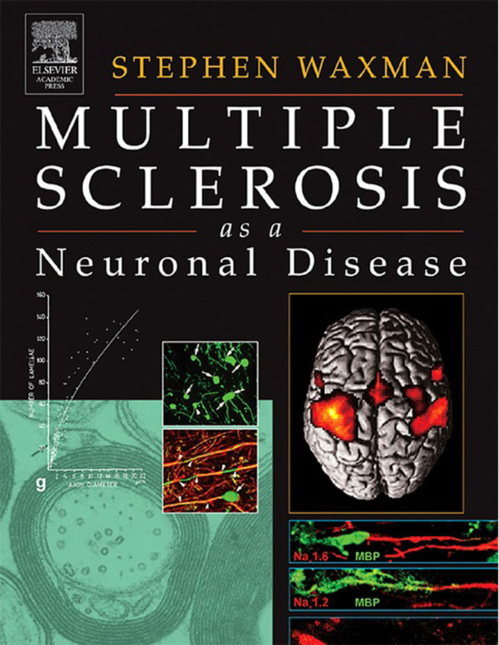 Multiple Sclerosis As A Neuronal Disease  â€“ PDF/EPUB Version Downloadable