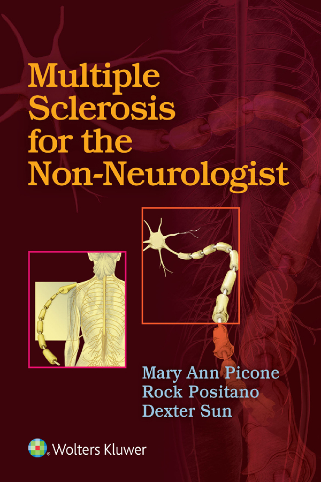 Multiple Sclerosis for the Non-Neurologist  â€“ PDF/EPUB Version Downloadable