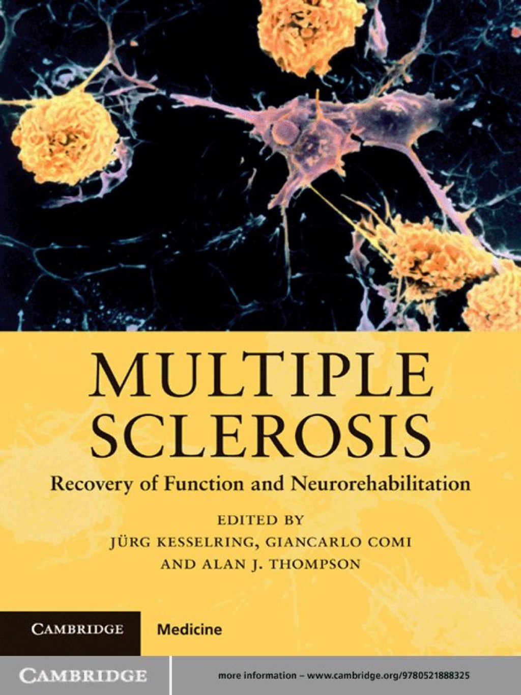 Multiple Sclerosis Recovery of Function and Neurorehabilitation 1st Edition â€“ PDF/EPUB Version Downloadable