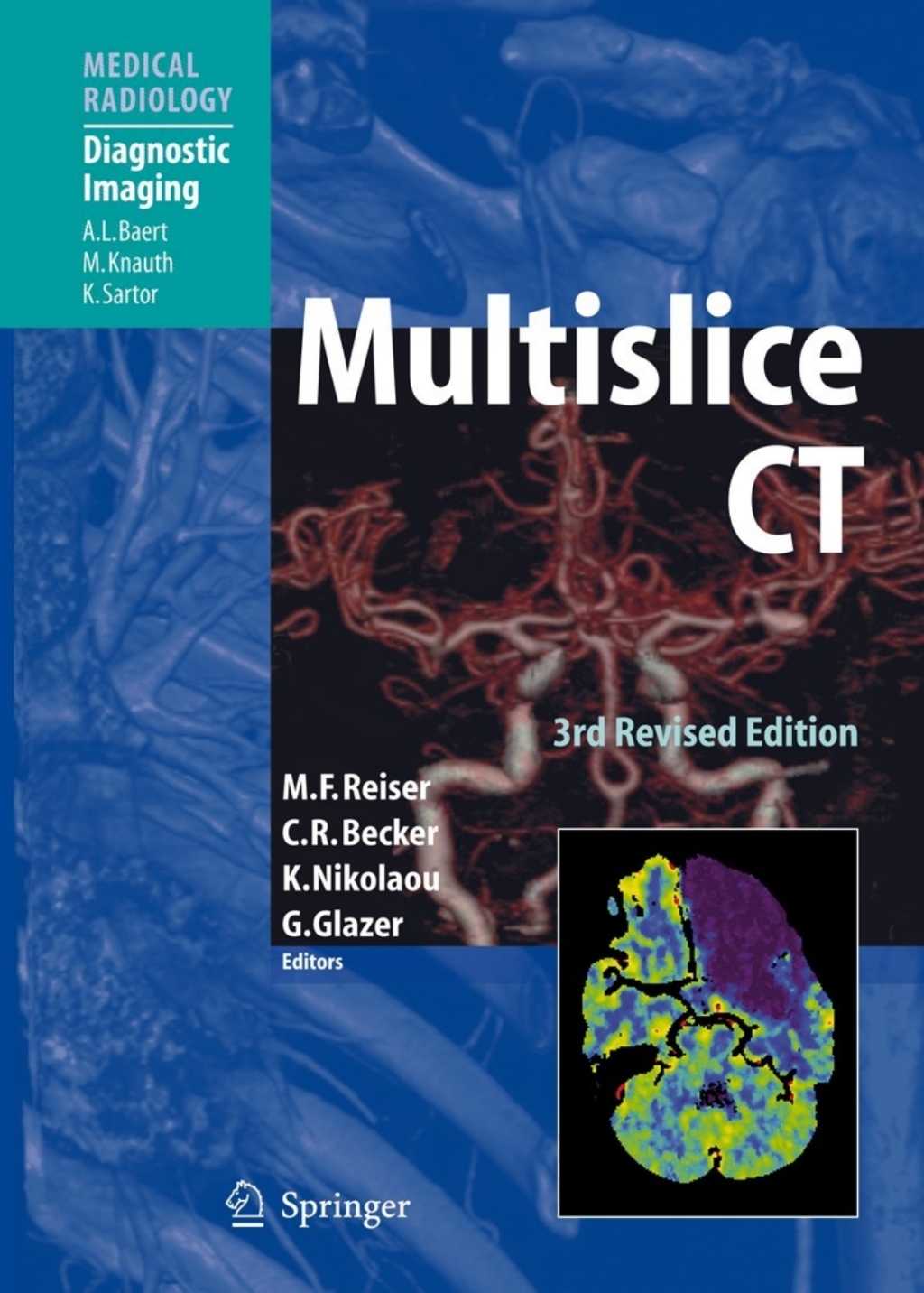 Multislice CT 3rd Edition â€“ PDF/EPUB Version Downloadable
