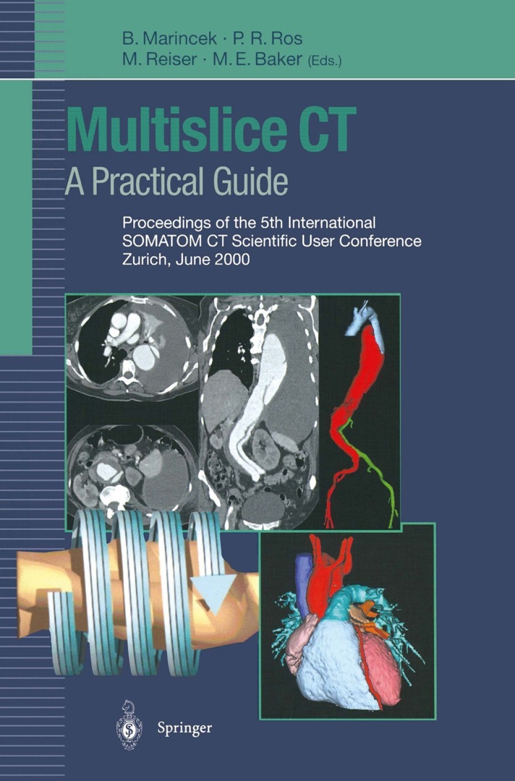 Multislice CT: A Practical Guide Proceedings of the 5th International SOMATOM CT Scientific User Conference Zurich, June 2000 1st Edition â€“ PDF/EPUB Version Downloadable