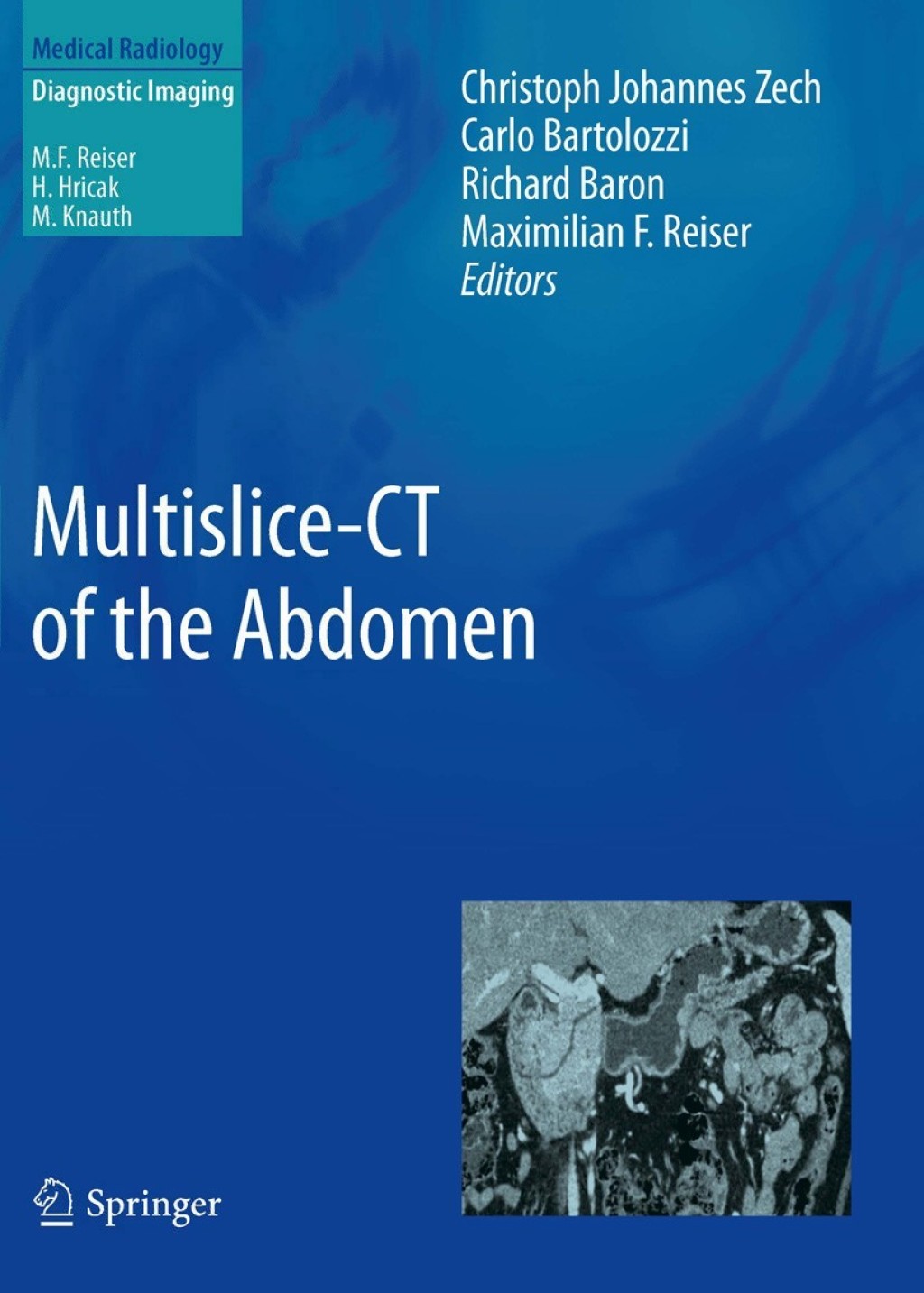 Multislice-CT of the Abdomen 1st Edition â€“ PDF/EPUB Version Downloadable