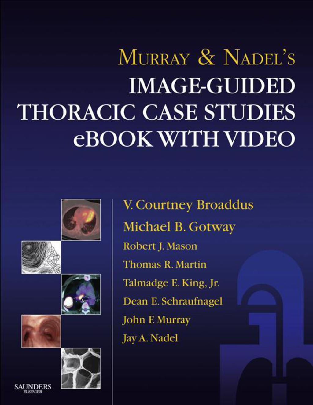 Murray & Nadelâ€™s Image-Guided Thoracic Case Studies with Video 5th Edition â€“ PDF/EPUB Version Downloadable