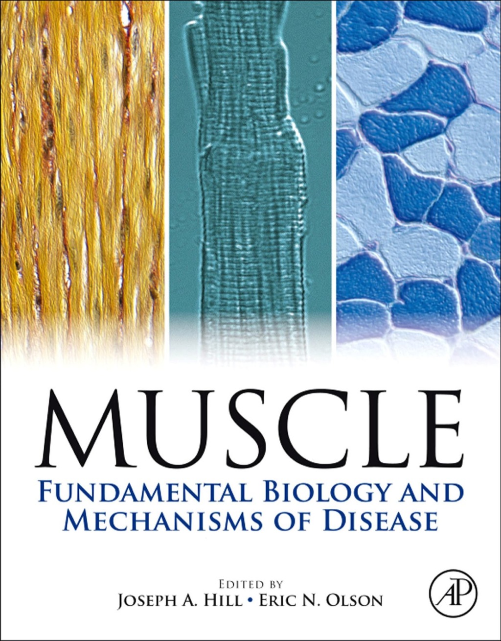 Muscle 2-Volume Set: Fundamental Biology and Mechanisms of Disease  â€“ PDF/EPUB Version Downloadable
