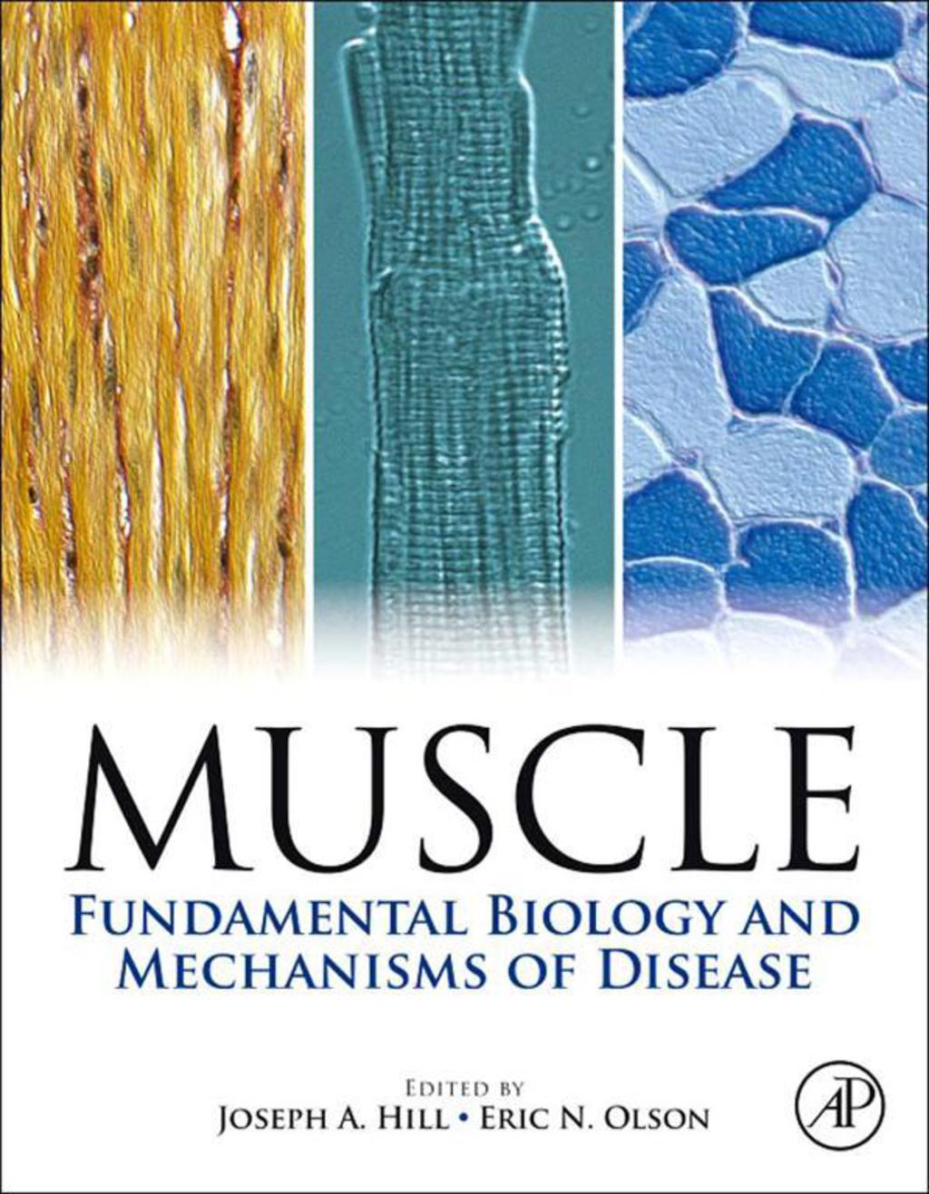 Muscle 2-Volume Set: Fundamental Biology and Mechanisms of Disease  â€“ PDF/EPUB Version Downloadable