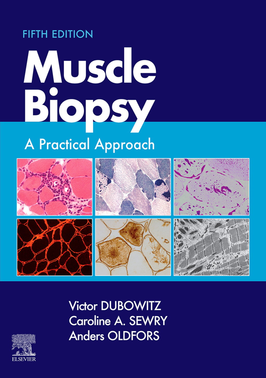 Muscle Biopsy A Practical Approach 5th Edition â€“ PDF/EPUB Version Downloadable