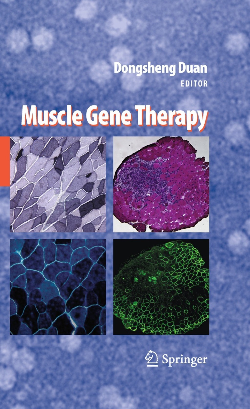 Muscle Gene Therapy 1st Edition â€“ PDF/EPUB Version Downloadable