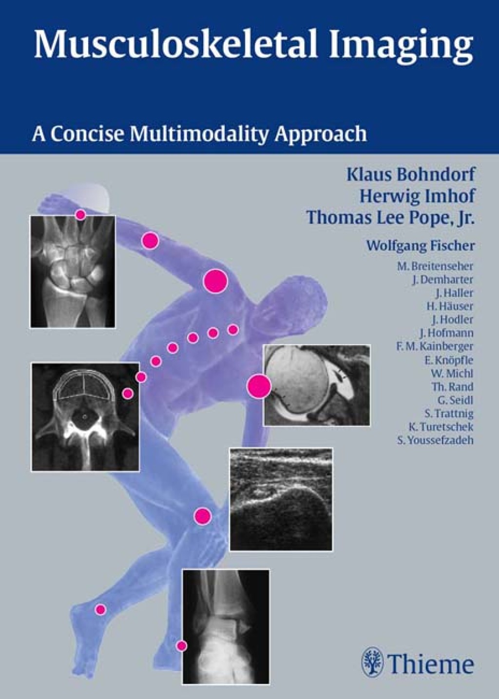 Musculoskeletal Imaging A Concise Multimodality Approach 1st Edition â€“ PDF/EPUB Version Downloadable