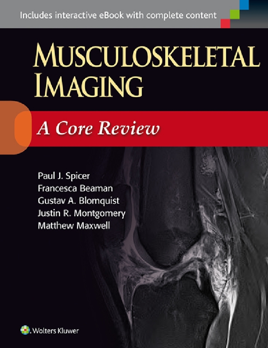 Musculoskeletal Imaging: A Core Review  â€“ PDF/EPUB Version Downloadable