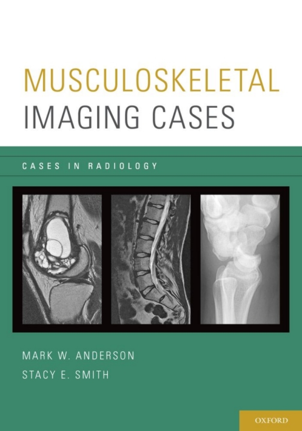 Musculoskeletal Imaging Cases  â€“ PDF/EPUB Version Downloadable