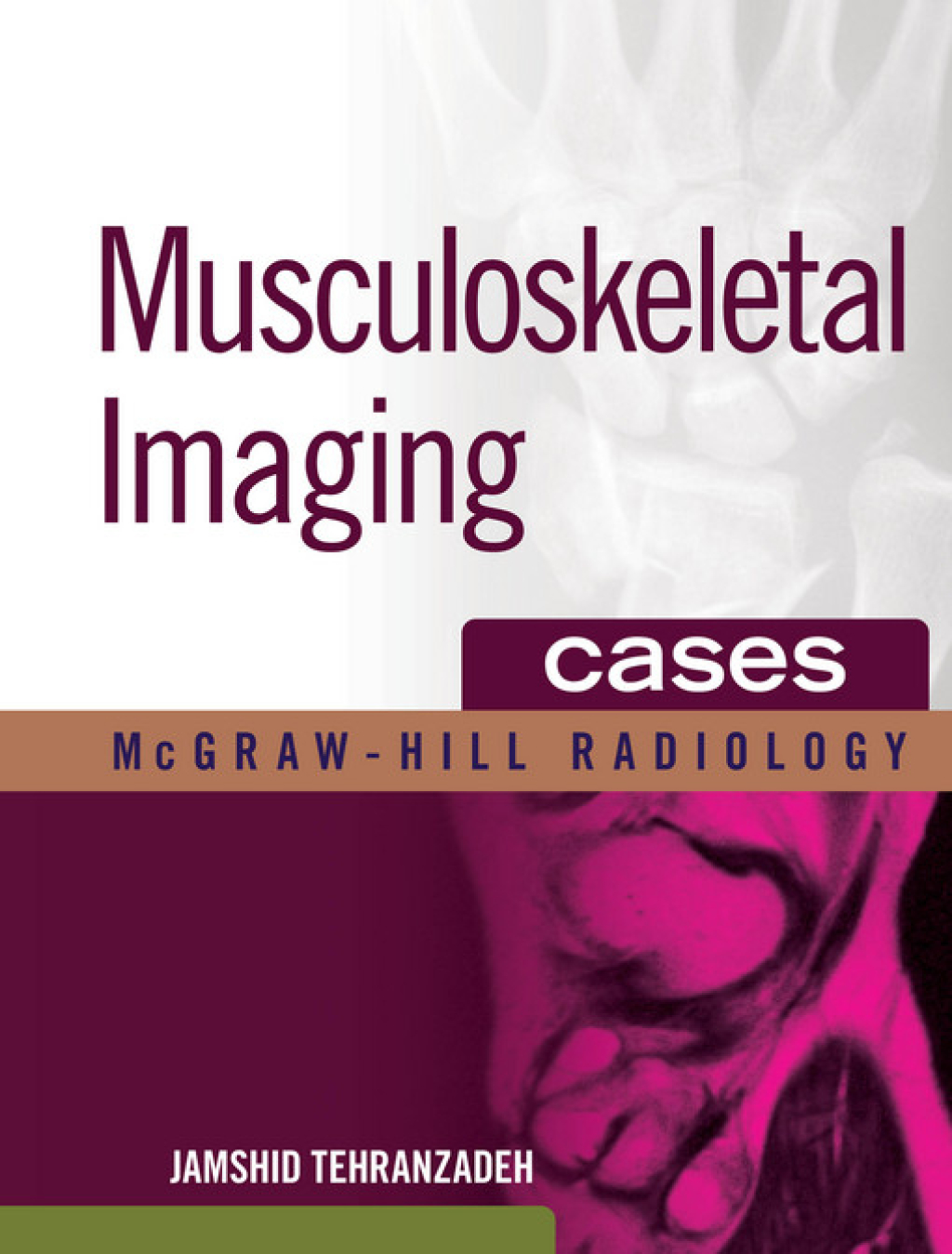 Musculoskeletal Imaging Cases 1st Edition â€“ PDF/EPUB Version Downloadable
